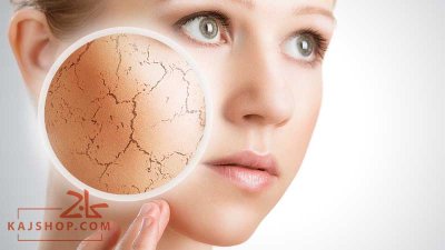 لکه‌ های خشکی روی پوست؛ علت‌ ها و نشانه‌ های مهم آن